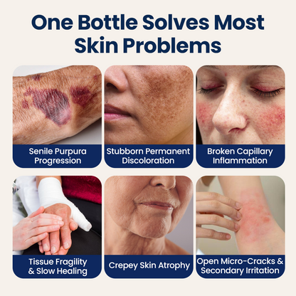 KUBOZN® DermFortify – Advanced Bruise Fading & Skin Thickening Cream for Thin, Fragile Skin